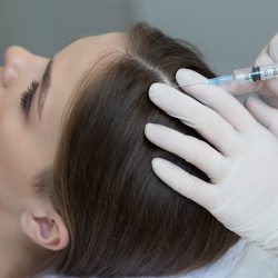 Treatment,Of,Hair,Loss,,Injection,For,Hair,Growth.,Injected,In Treatment,Of,Hair,Loss,,Injection,For,Hair,Growth.,Injected,In